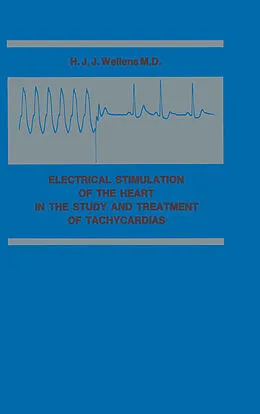 E-Book (pdf) Electrical Stimulation of the Heart in the Study and Treatment of Tachycardias von Hein J. J. Wellens