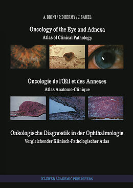 Kartonierter Einband Oncology of the Eye and Adnexa / Oncologie de l  il et des Annexes / Onkologische Diagnostik in der Ophthalmologie von A. Brini, J. Sahel, A. Dhermy