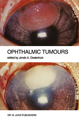 Kartonierter Einband Ophthalmic Tumours von 