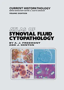 E-Book (pdf) Atlas of Synovial Fluid Cytopathology von Anthony J. Freemont, Jayne Denton