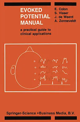 E-Book (pdf) Evoked Potential Manual von E. Colon, S. L. Visser, J. P. C de Weerd