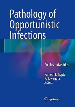 eBook (pdf) Pathology of Opportunistic Infections de 