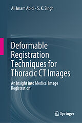 eBook (pdf) Deformable Registration Techniques for Thoracic CT Images de Ali Imam Abidi, S. K. Singh