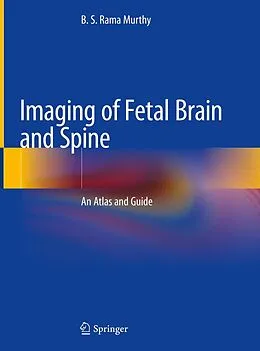 E-Book (pdf) Imaging of Fetal Brain and Spine von B. S. Rama Murthy