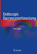 E-Book (pdf) Endoscopic Dacryocystorhinostomy von Nishi Gupta