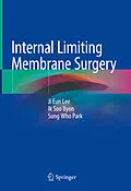 E-Book (pdf) Internal Limiting Membrane Surgery von Ji Eun Lee, Ik Soo Byon, Sung Who Park