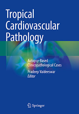 Couverture cartonnée Tropical Cardiovascular Pathology de 