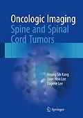 E-Book (pdf) Oncologic Imaging: Spine and Spinal Cord Tumors von Heung Sik Kang, Joon Woo Lee, Eugene Lee