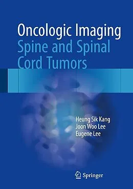 E-Book (pdf) Oncologic Imaging: Spine and Spinal Cord Tumors von Heung Sik Kang, Joon Woo Lee, Eugene Lee