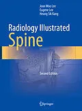 E-Book (pdf) Radiology Illustrated: Spine von Joon Woo Lee, Eugene Lee, Heung Sik Kang