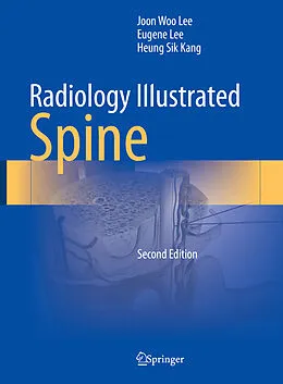 E-Book (pdf) Radiology Illustrated: Spine von Joon Woo Lee, Eugene Lee, Heung Sik Kang