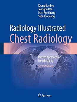E-Book (pdf) Radiology Illustrated: Chest Radiology von Kyung Soo Lee, Joungho Han, Man Pyo Chung
