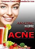 E-Book (epub) Amazing Home Remedies for Acne, Symptoms Causes and Remedies For Acne von M. Laurence