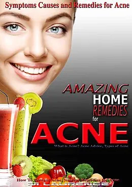 E-Book (epub) Amazing Home Remedies for Acne, Symptoms Causes and Remedies For Acne von M. Laurence