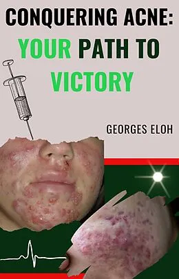 E-Book (epub) Conquering Acne: Your Path to Victory von Georges Eloh