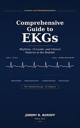 E-Book (epub) Comprehensive Guide to EKG's Rhythms, 12 leads, and Clinical Patterns at Bedside von Jeremy Boroff Pa-C