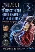 E-Book (epub) Cardiac CT for Transcatheter Right Heart Interventions: Practical Insights von Taha Othmane