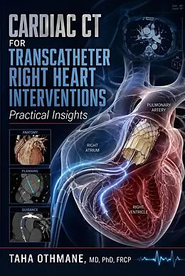 E-Book (epub) Cardiac CT for Transcatheter Right Heart Interventions: Practical Insights von Taha Othmane